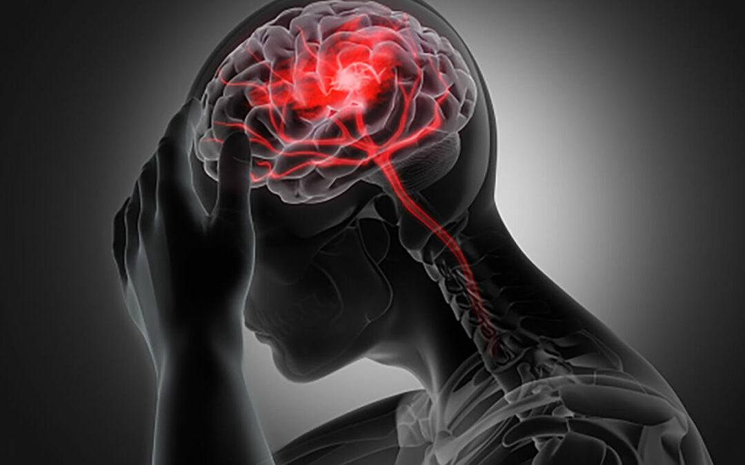 Brain Injuries and Auto Accidents