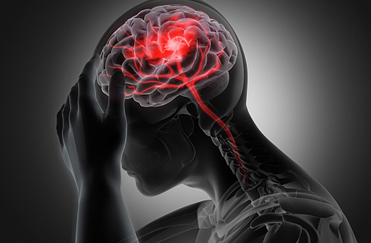 brain injuries and car accidents
