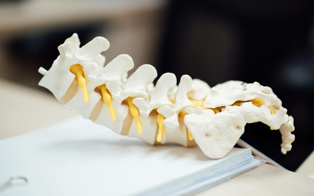 Chiropractic Biophysics: What is it and How Can it Help Recovery?
